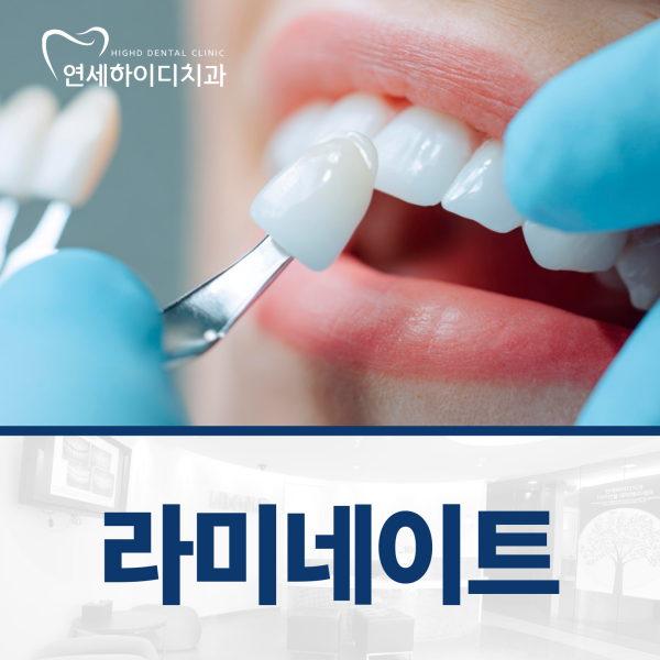 3. 라미네이트, 환한미소.png